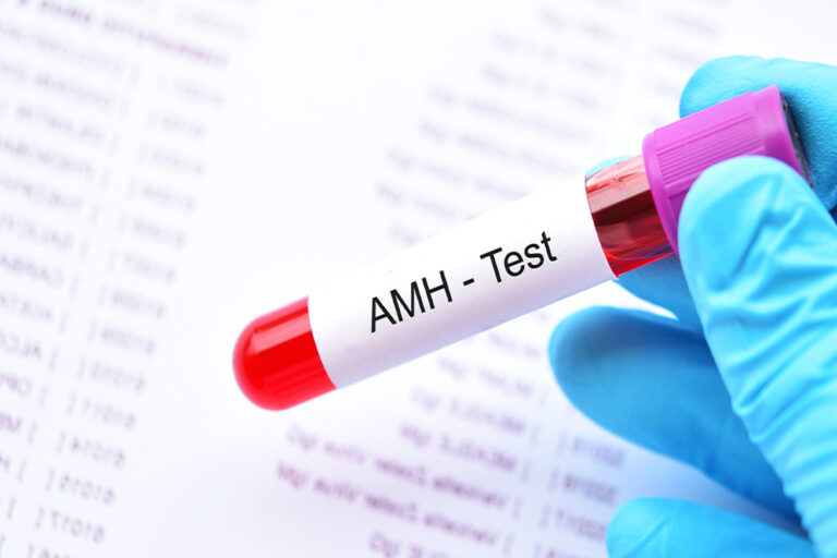 What is the AMH Test?